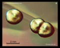 escherichia coli